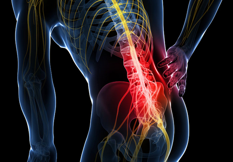 What is the cause of lower back pain?