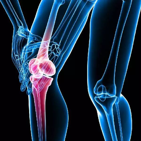 How to relieve knee pain? – Zenopax store