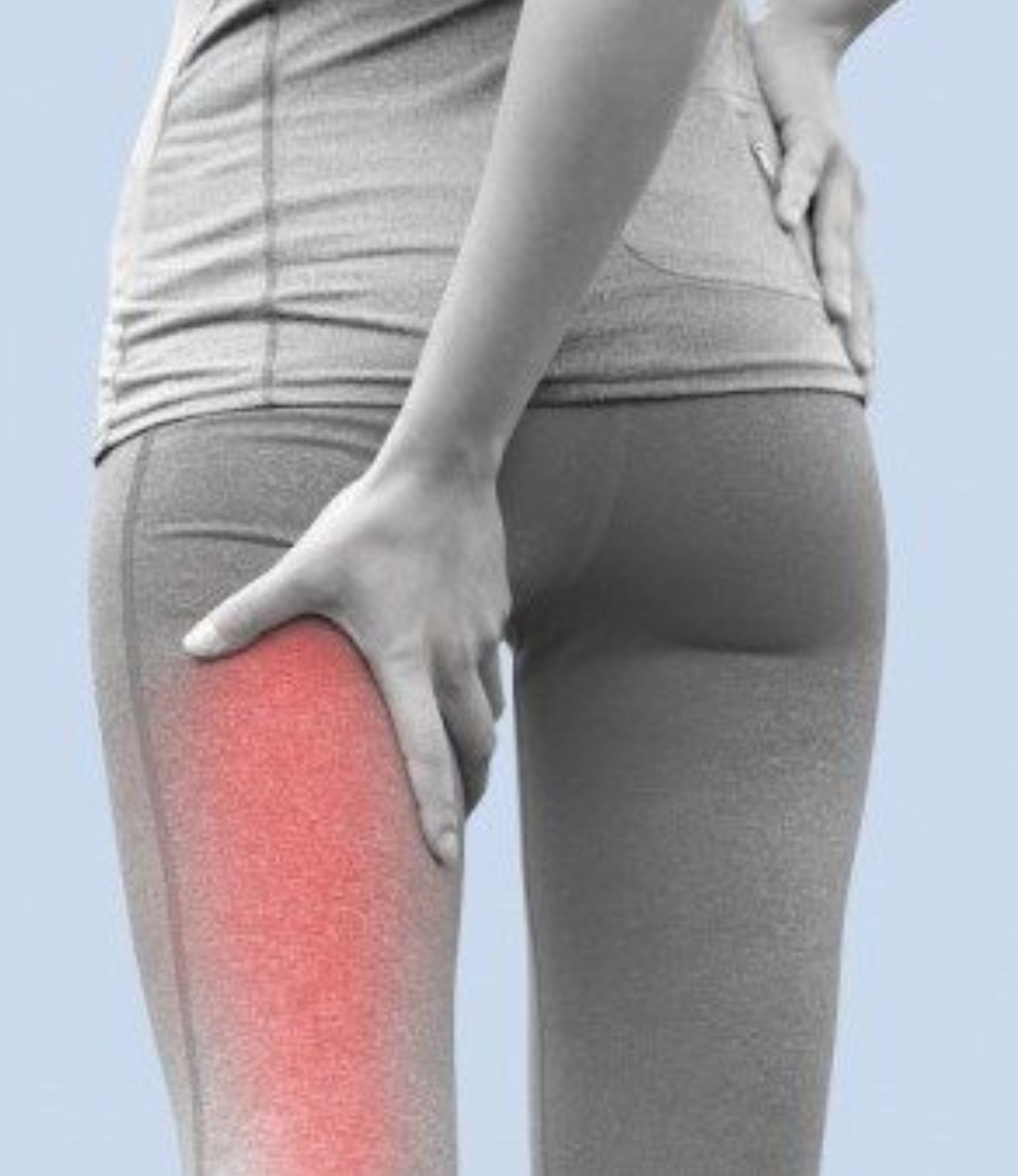 Everything you need to know about sciatica is here