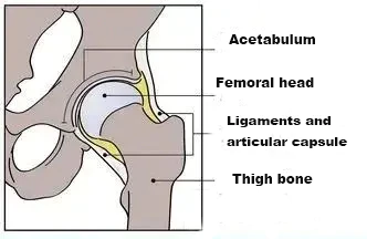 The real cause of knee pain is not exercise, but it