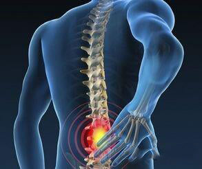 "Low back pain" of sacroiliac joint pain causes and motor recovery